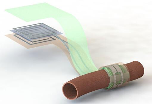 上圖描繪了這款可生物降解的壓力傳感器，它圍繞著一根血管，天線在左側(cè)(分離的層狀結(jié)構(gòu)，展示了天線結(jié)構(gòu)的細節(jié))